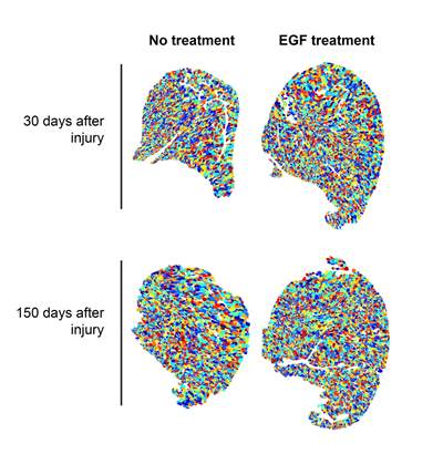 EGF treatment enhances muscle repair after injury in a mouse model of Duchenne muscular dystrophy. Colour represents individual muscle fibers in muscle cross sections. Image courtesy of Cell Stem Cell.